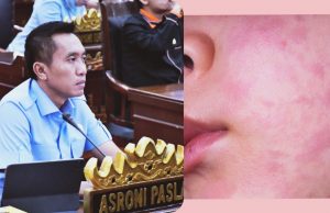 Kasus Campak Meningkat, Komisi IV DPRD Bandar Lampung Desak Pemerintah Jangan Lalai